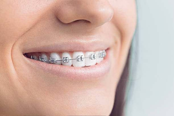 Best Dental Bonding  in Milton, WI